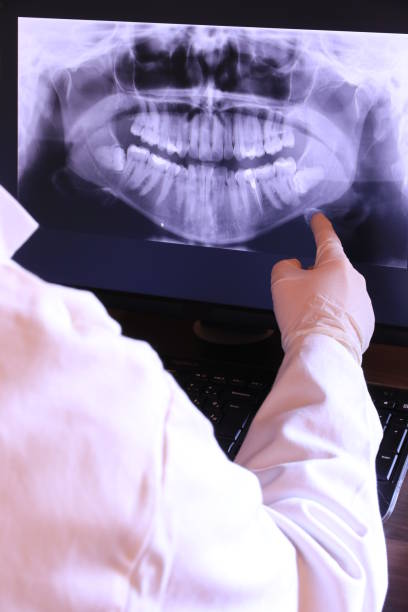 Best Emergency Treatment for Toothache in Alton, TX